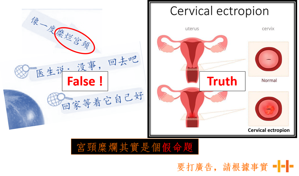 Cervical ectropion