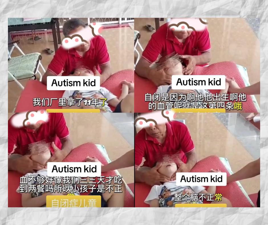 自閉症