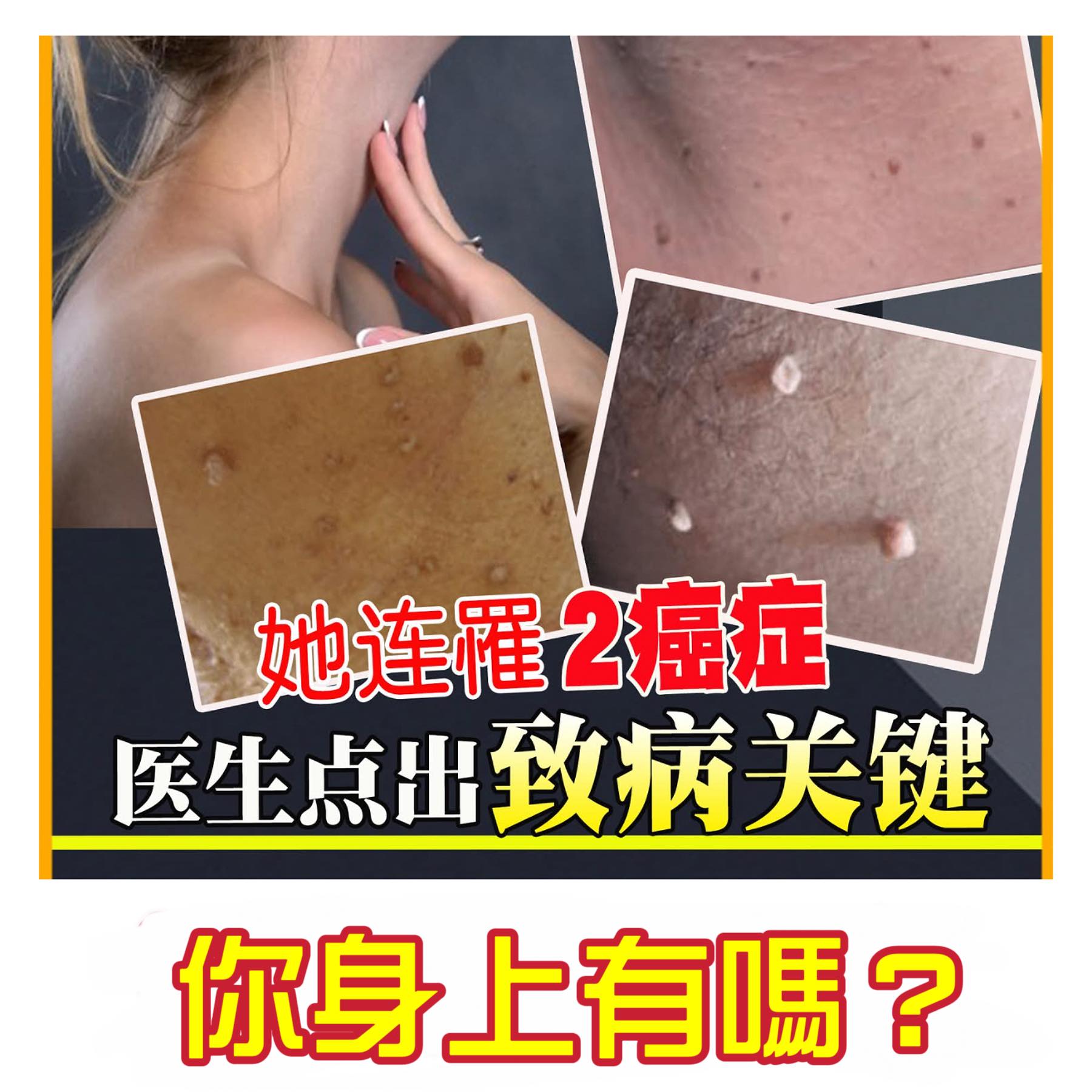 生病症狀