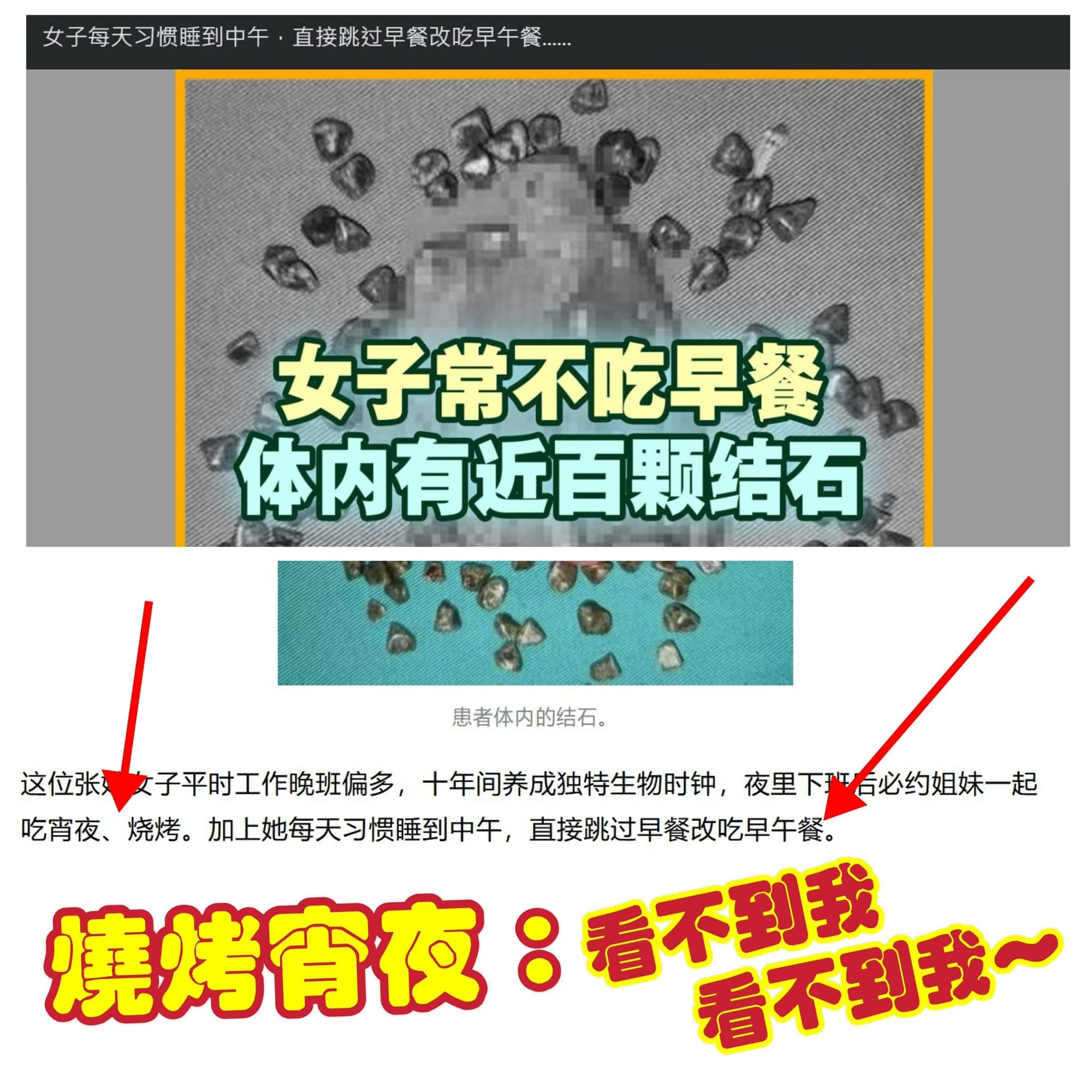 不吃早餐會不會造成膽結石？